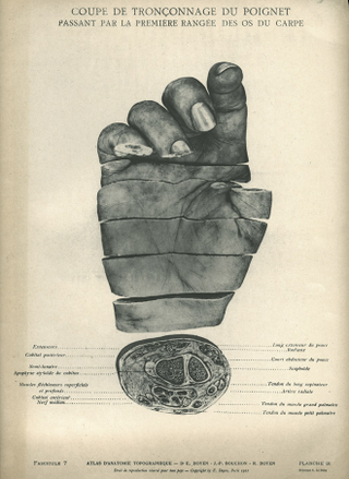Illustration for article titled Behold, an X-ray of Hitler's head